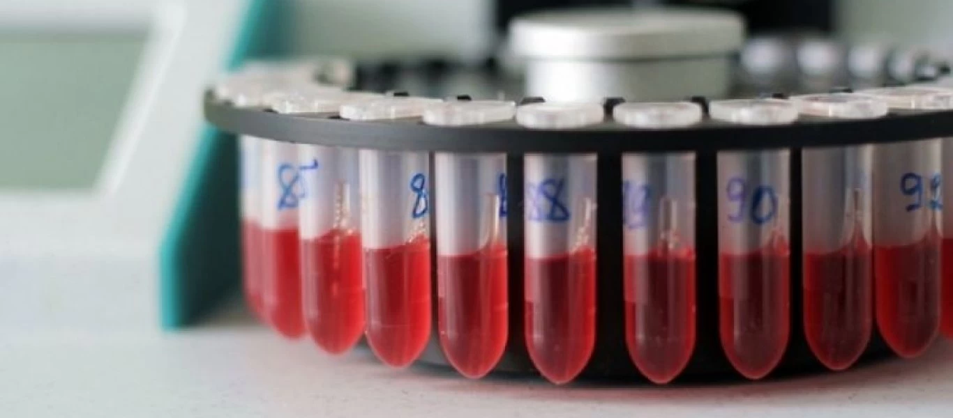 H σπανιότερη ομάδα αίματος - Την έχουν 50 άτομα παγκοσμίως